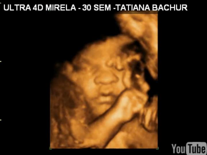 TE AGRADEÇO pelo presente do médico e pela perfeição de Mirela...